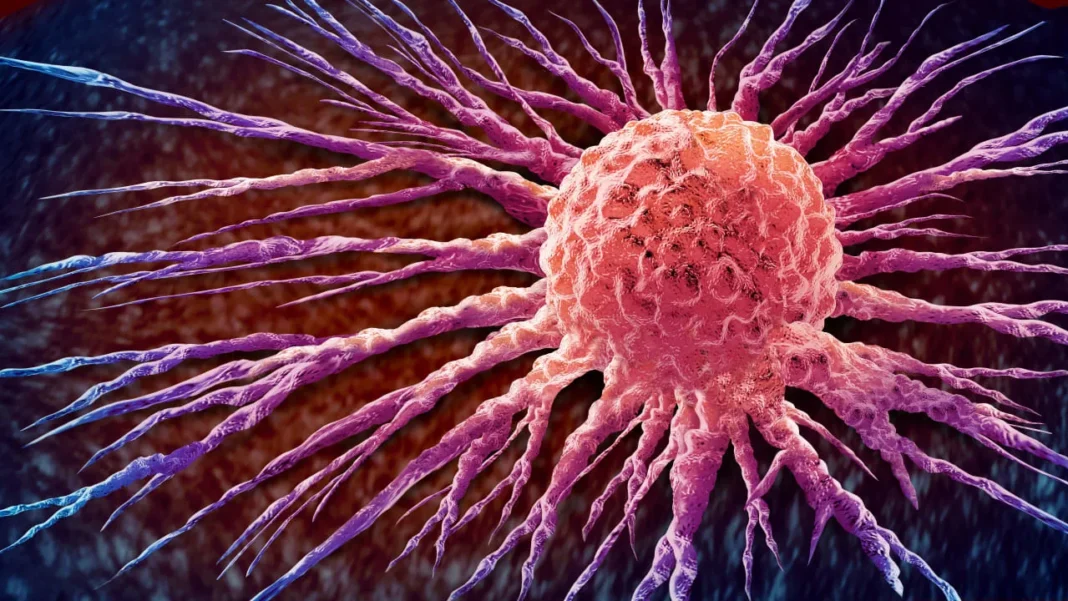 Cancer Cell Spread and oncology or Malignant Cancerous Growth and Metastasis anatomy concept as growing tumor cells and Malignancy disease spreading metastasized as a 3D illustration.