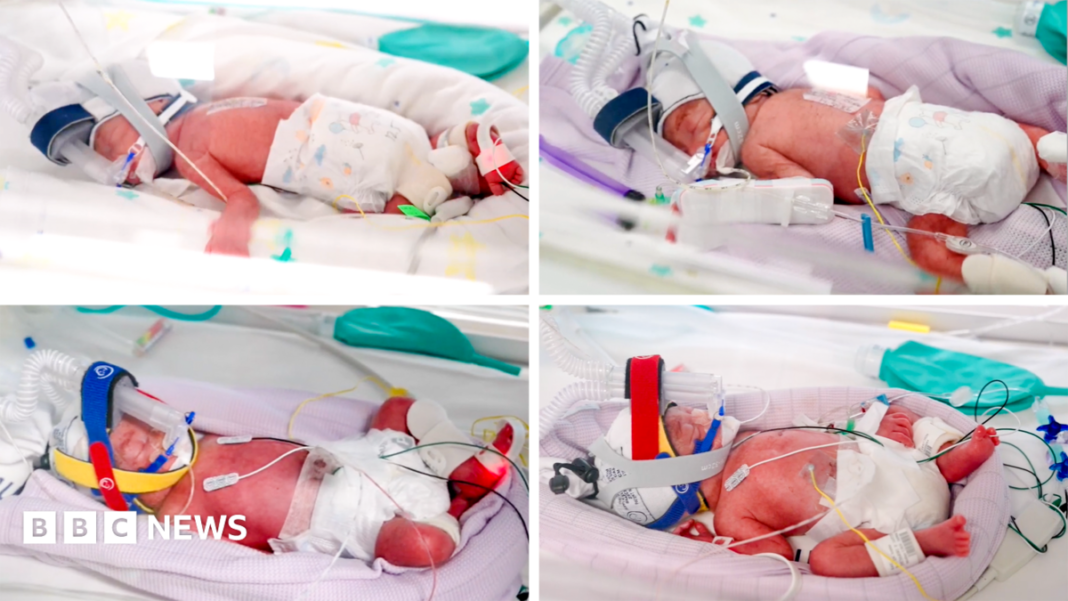 Rare identical quadruplets born in Australia Rare identical quadruplets born in Australia