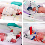 Rare identical quadruplets born in Australia